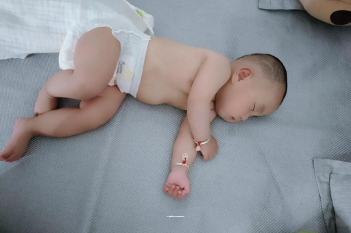中卫宝宝褶皱处擦粉还是油